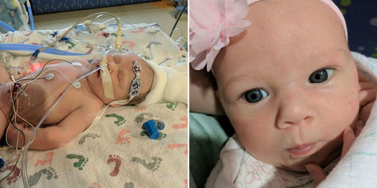 When Doctors Told These Expecting Parents to Give Up, They Defied the ...