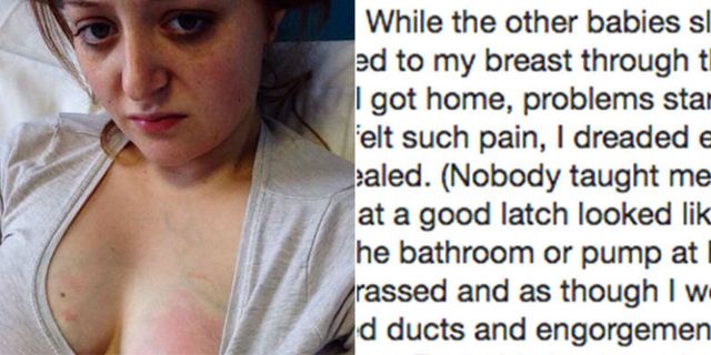 Mom Wants All Breastfeeding Mothers To Know About Her Mastitis Experience Mom S Viral Photo Shows The Pain Of This Breastfeeding Complication