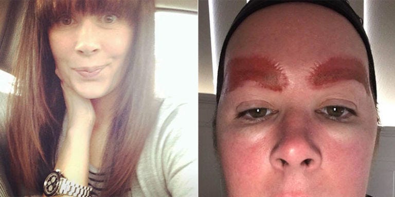 This is What a Bad Reaction to Microblading Looks Like - Microblading