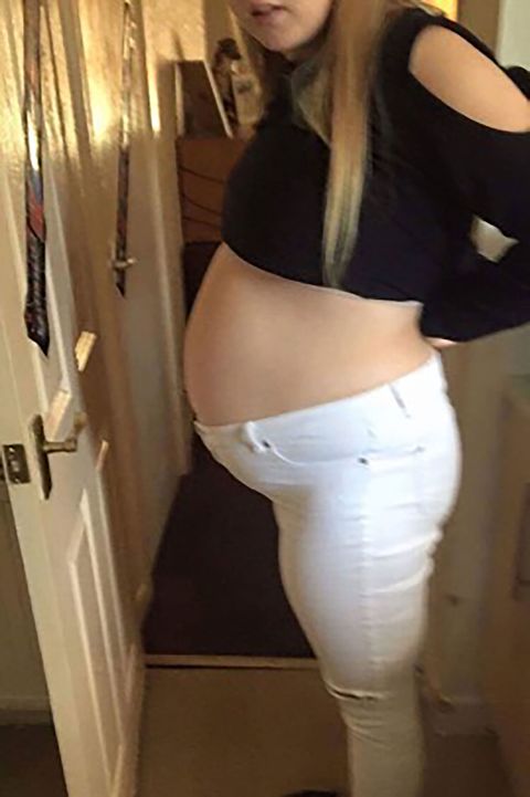 Pregnant Women Discovers Giant Cyst in Baby Bump - Kirsty Butler ...