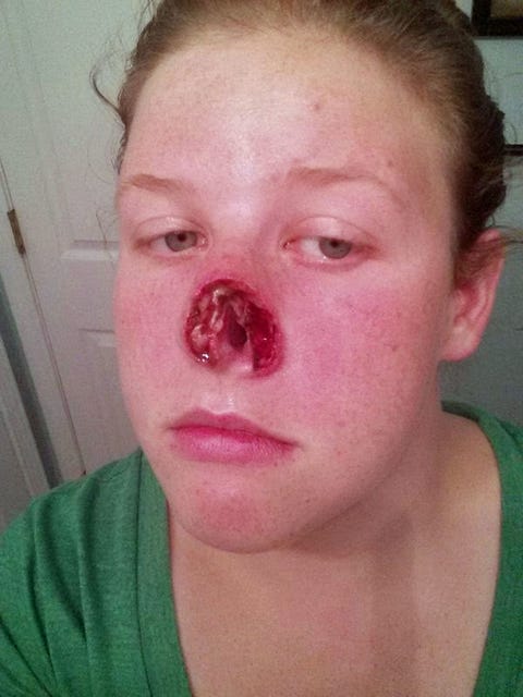 Removing Nose Ring With Ball Removing Nose Ring With Ball