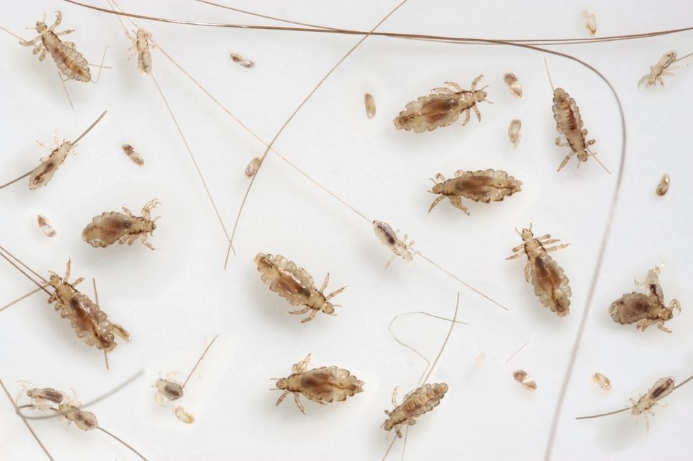 head lice, nymphs and nits