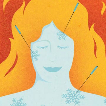 acupuncture