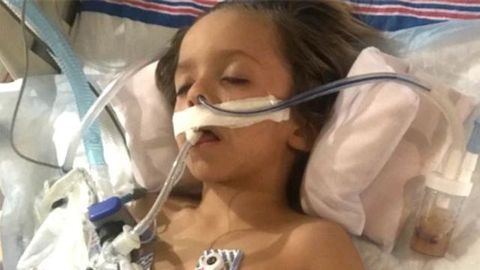 preview for 6-Year-Old Dies of Rabies After Getting Scratched by a Bat
