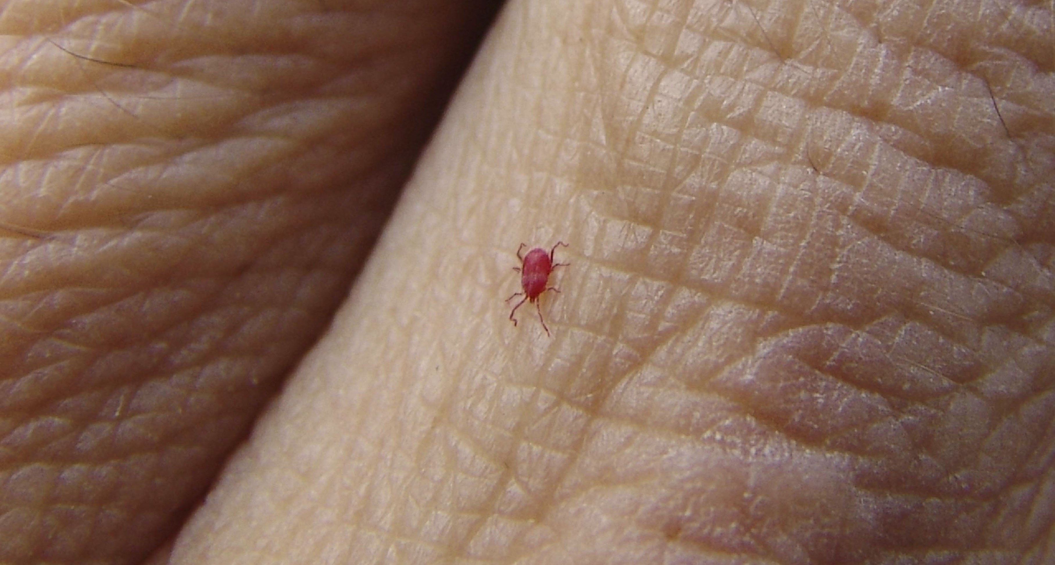 tiny red bugs