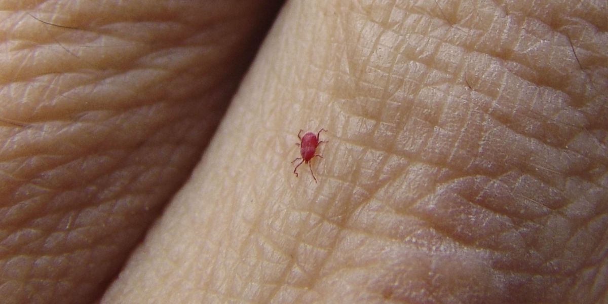 How to Get Rid of Chiggers - Eliminate Red Mites and Bugs From Your Yard