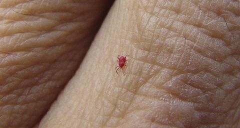 How To Get Rid Of Chiggers Eliminate Red Mites And Bugs