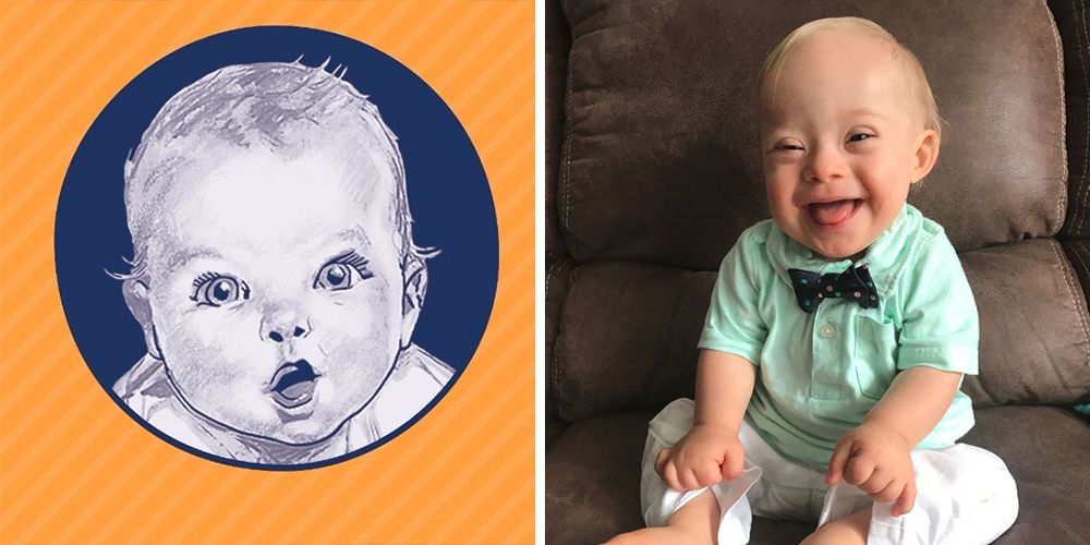 gerber baby with downs