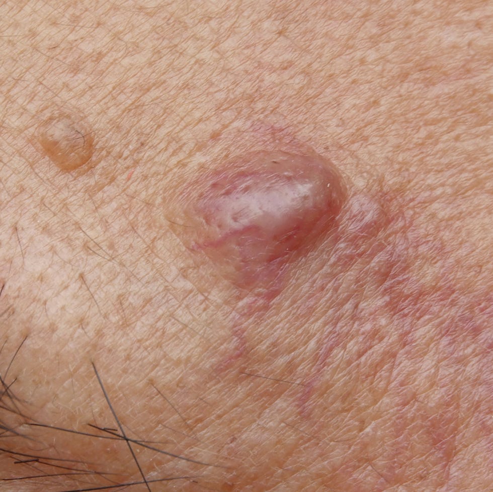 Common Scalp Issues: Pictures, Causes and Treatments Common Scalp Issues: Pictures, Causes and Treatments
