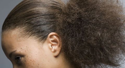 How To Fix Greasy Hair Easy Solutions To Fight Greasy Frizzy