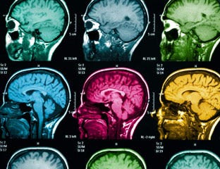 CT Scan Side Effects - Risks of a CT Scan