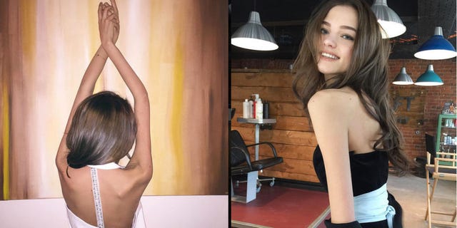 Anoressia nervosa, le parole giuste da dire a una ragazza ...