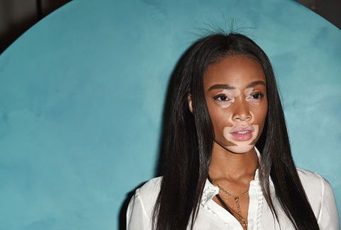 <p>Nulla di facile, nulla di scontato nemmeno per <strong data-redactor-tag="strong" data-verified="redactor">Winnie Harlow</strong>. Lei, 22enne canadese di Toronto, è infatti la prima modella con la vitiligine a sfilare sulle passerelle e a diventare testimonial di due marchi come Desigual e Diesel. Eppure Ladybug, come la chiamano i fan, che <a data-tracking-id="recirc-text-link" href="http://www.elle.com/it/moda/abbigliamento/news/g1782/mtv-ema-red-carpet-2016-abiti/" target="_blank">quest'anno ha incantato anche gli EMA</a>, prima di arrivare al successo ne ha patite di ogni tipo, dal brutale bullismo subito a scuola fino alla raffica di no delle agenzie di moda. Tutto è cambiato, però, con la partecipazione ad <em data-redactor-tag="em" data-verified="redactor">America Next Top Model </em><span class="redactor-invisible-space" data-redactor-class="redactor-invisible-space" data-redactor-tag="span" data-verified="redactor">dove, grazie il sostegno sfegatato della produttrice ed ex modella <strong data-redactor-tag="strong" data-verified="redactor">Tyra Banks</strong>, ha iniziato a prendere forma la carriera di una delle modelle con più grinta e personalità al mondo. </span><span class="redactor-invisible-space" data-redactor-class="redactor-invisible-space" data-redactor-tag="span" data-verified="redactor"></span></p>