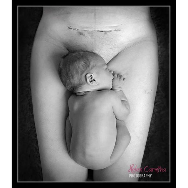 Cheek, Skin, Shoulder, Joint, Chest, Trunk, Abdomen, Stomach, Barechested, Muscle, 