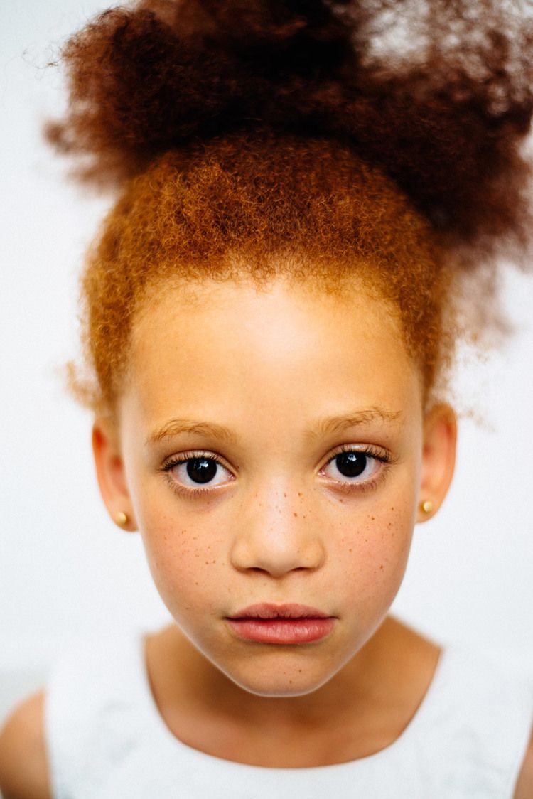 Stunning Pics Show Beauty Of Redheads Of Colour