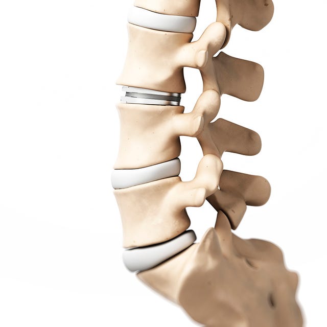 Joint, Trunk, Abdomen, Waist, Stomach, Thigh, Muscle, Tan, Beige, Chest, 
