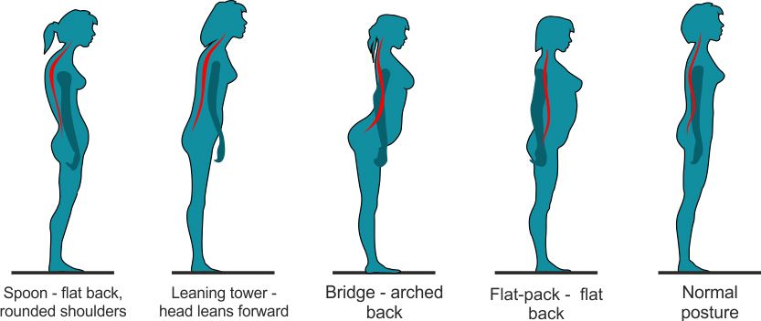 HOW TO ASSESS YOUR POSTURE - SIDE VIEW