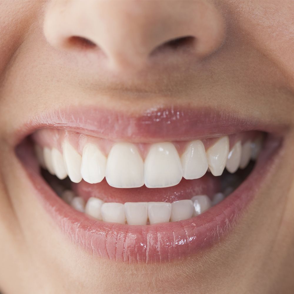 14 tips from dentists to whitening your teeth without treatment photo