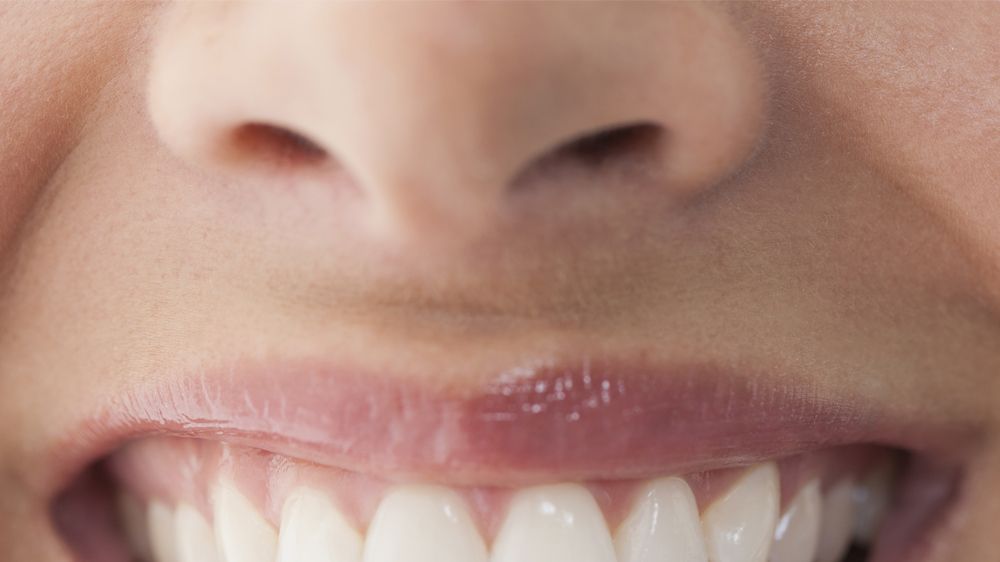 White spots on teeth: 11 tips on how to get rid of them