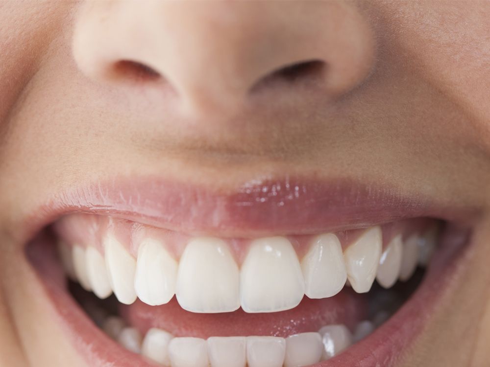 zwak dwaas versneller 14 tips from dentists to whitening your teeth without treatment