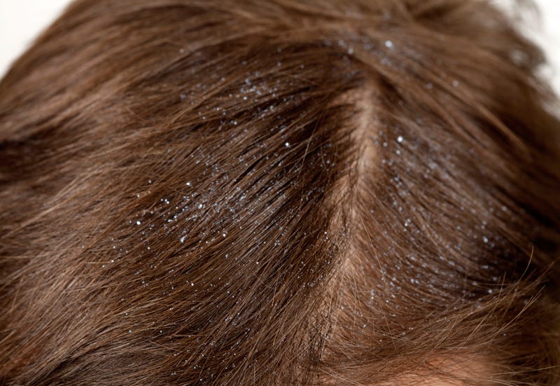Brown, Hairstyle, Style, Brown hair, Hair coloring, Liver, Fawn, Close-up, Photography, Hair care, 