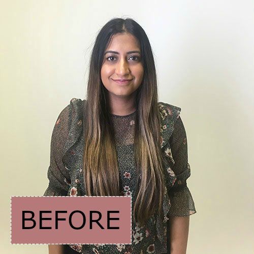 Hirsutism: What It Is, In Women, Causes, PCOS & Treatment