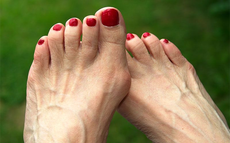 Toe, Foot, Nail, Leg, Finger, Skin, Human leg, Joint, Hand, Barefoot, 