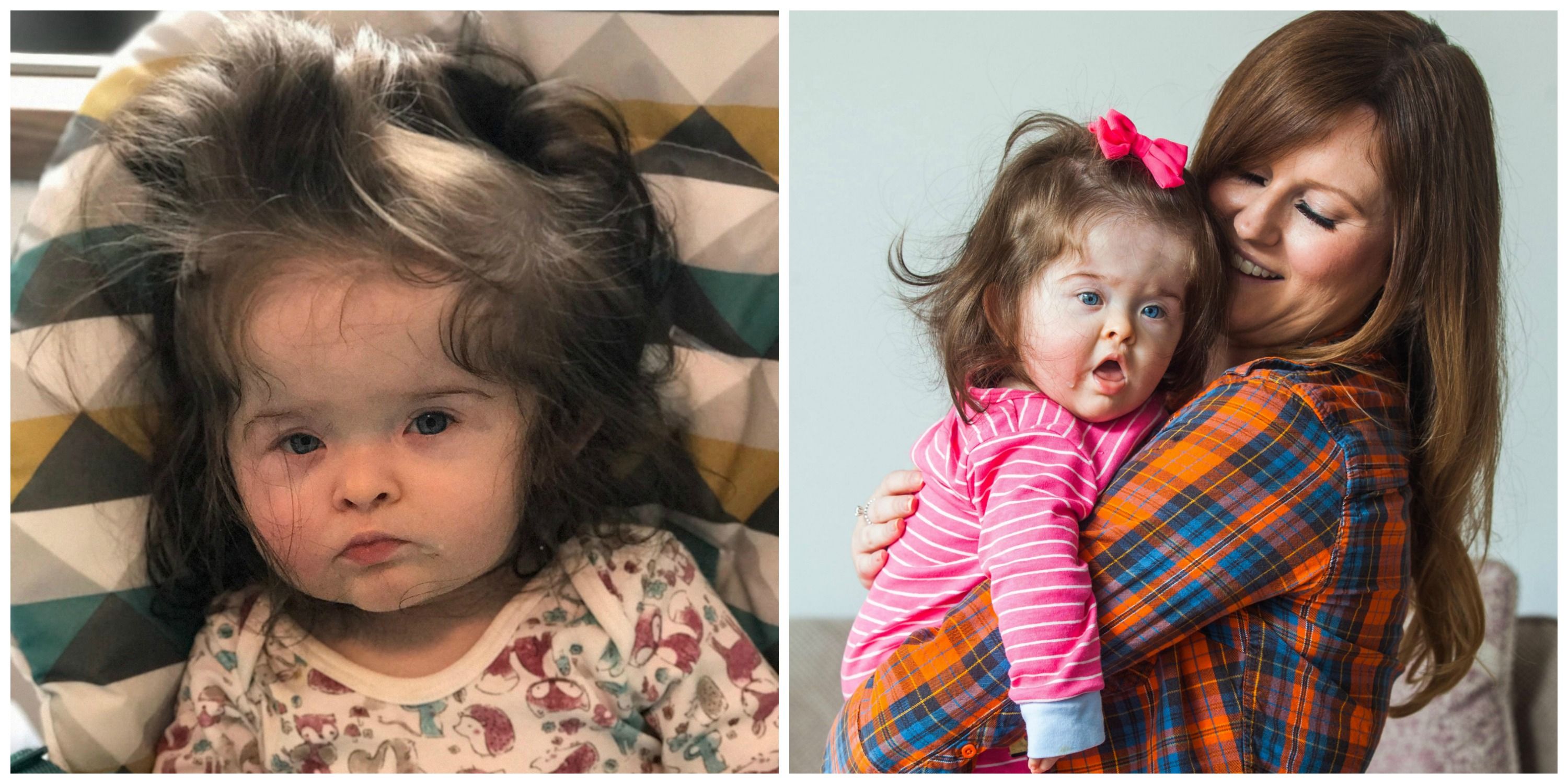 11-Month-Old Baby with 11-Month-Old Baby with