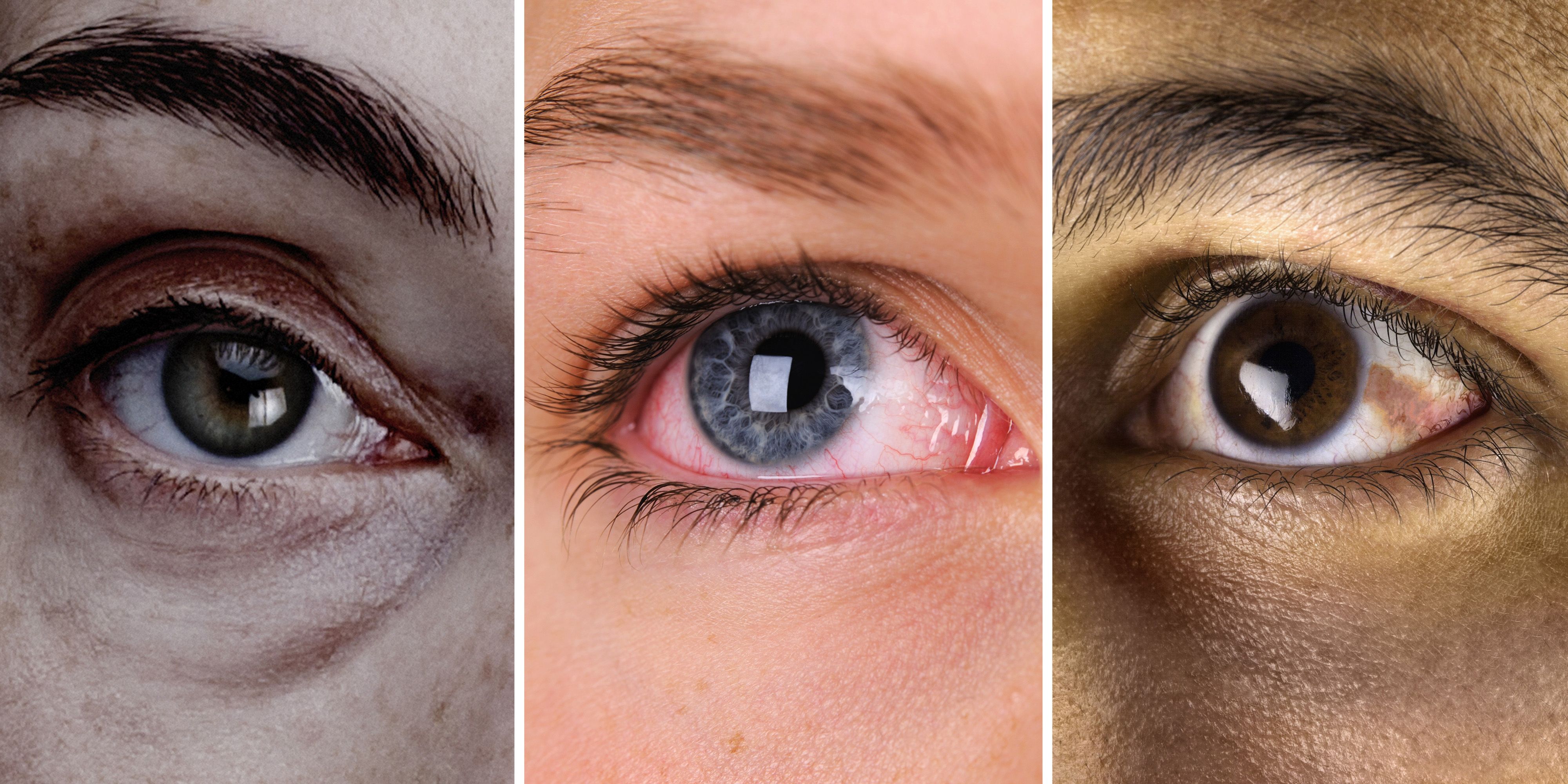 What Your Eyes Can Tell You About Your Health - Eye Problems