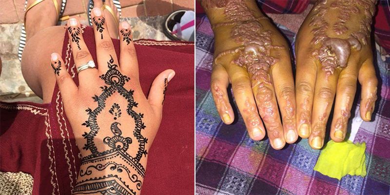 Beware! This kind of henna is harmful for UAE residents - News | Khaleej  Times