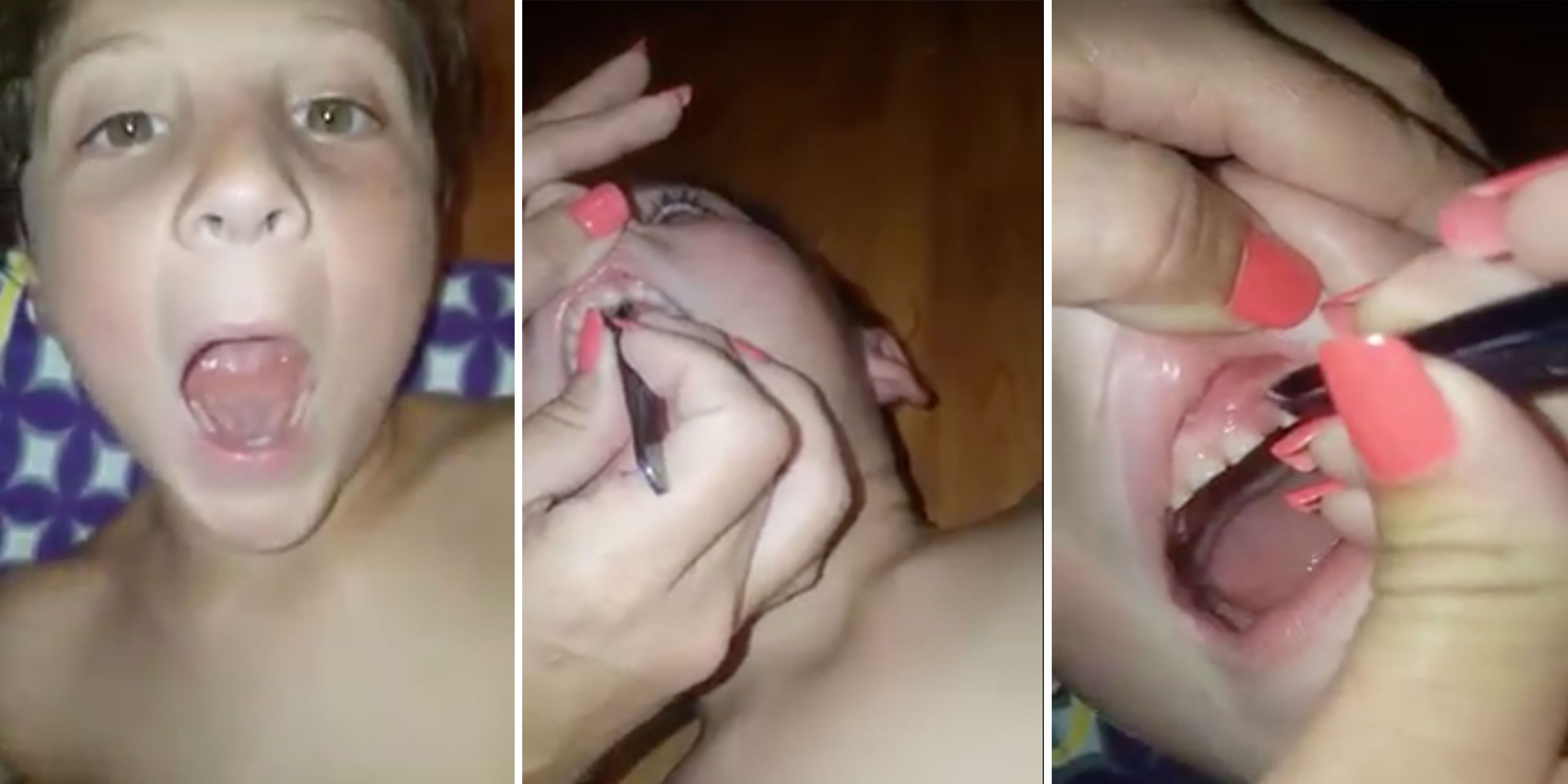Mom's Warning About Nail Biting Goes Viral - Facebook Post Shows Why Kids  Shouldn't Bite Their Nails