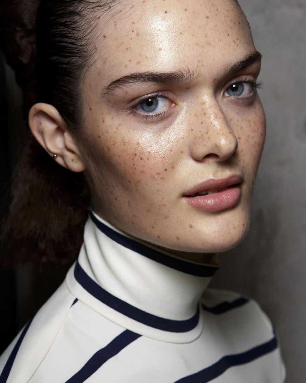 Micro trend: freckles
