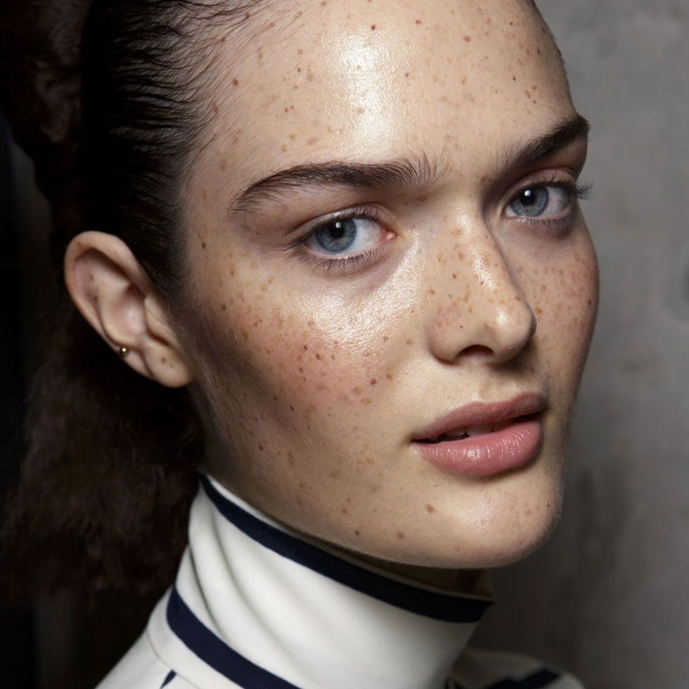Micro trend: freckles