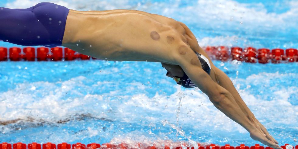 michael phelps has cupping