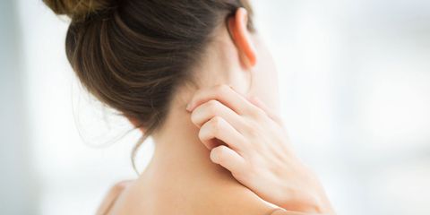 Woman scratching - eczema