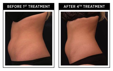 vanquish fat piersk reviews