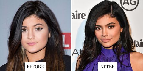 Celebrity Eyebrow Before And After- Celebrity Eyebrow Transformations