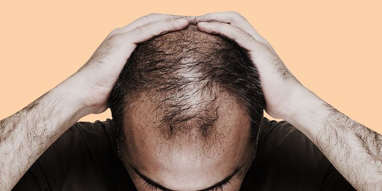 end balding and greying