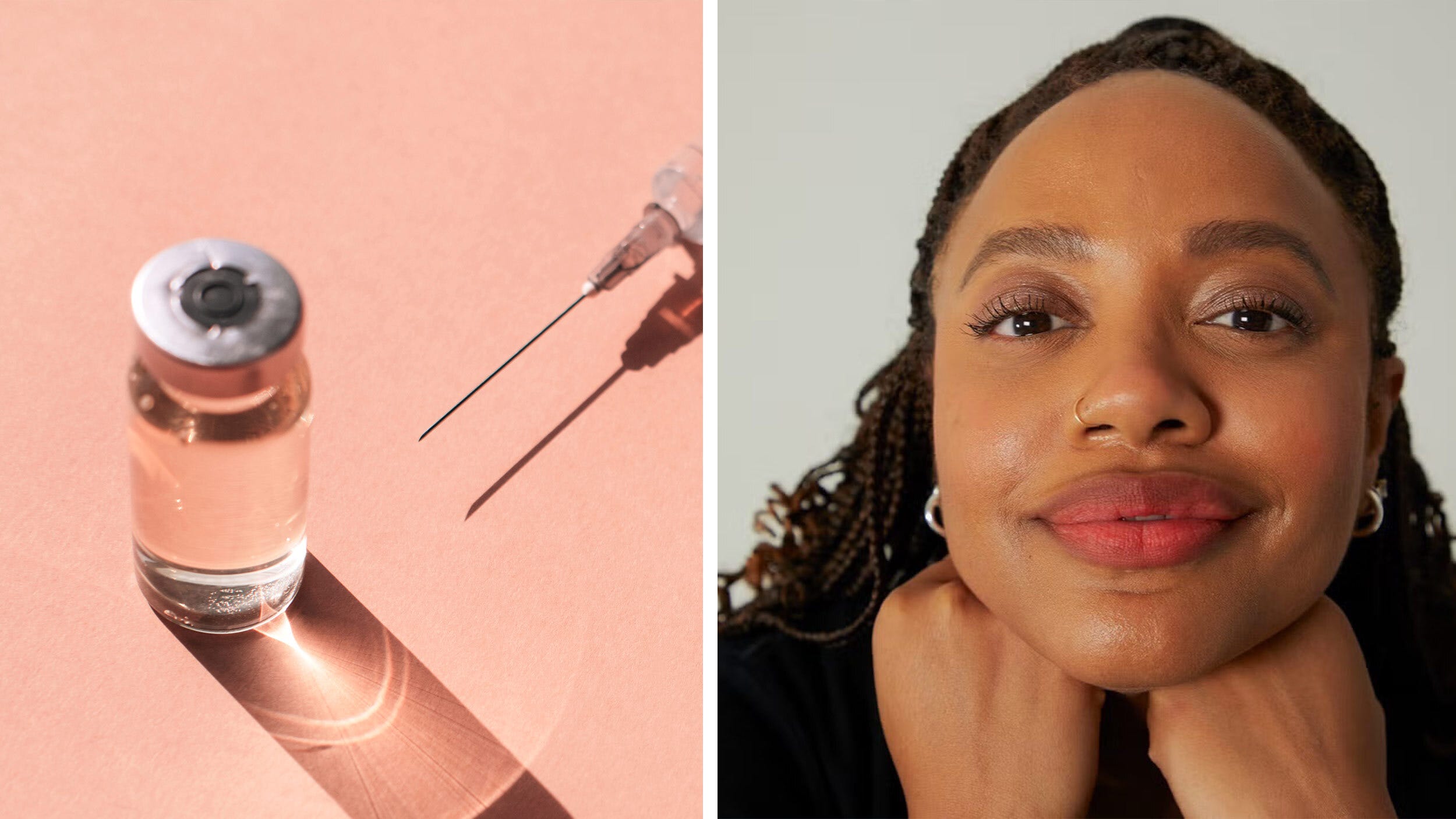 I Just Got Botox for the First Time in My 30s