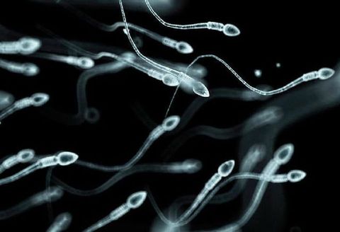 男性不妊を軽く見ない 家でできる スマホを使った精子検査キットの使い方 体験レポート