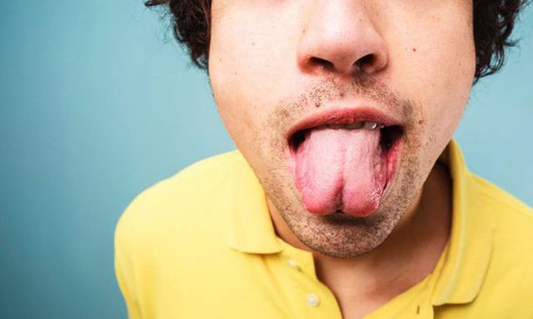 舌を見れば分かる 6つの健康状態