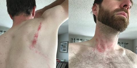 drunkcyclist golden colorado mountain biker assaulted by trail runner