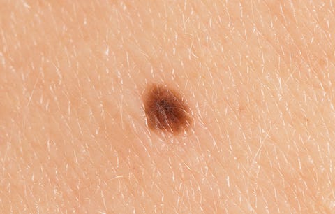 5 Signs Of Skin Cancer That Are Easy To Overlook Bicycling 5 Signs Of Skin Cancer That Are Easy To Overlook Bicycling