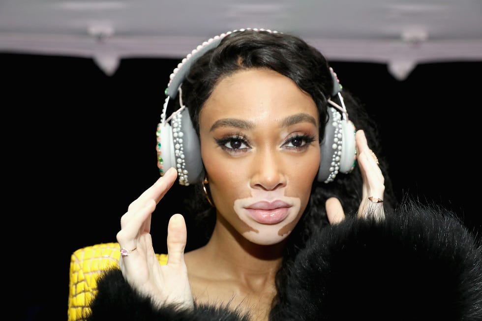 Winnie Harlow May or May Not be Starting a Beauty Line