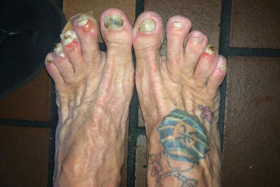 Ever Seen 981 Ugly Feet Photos - Free \u0026 Royalty 26 Celebs With Ugly Fe...
