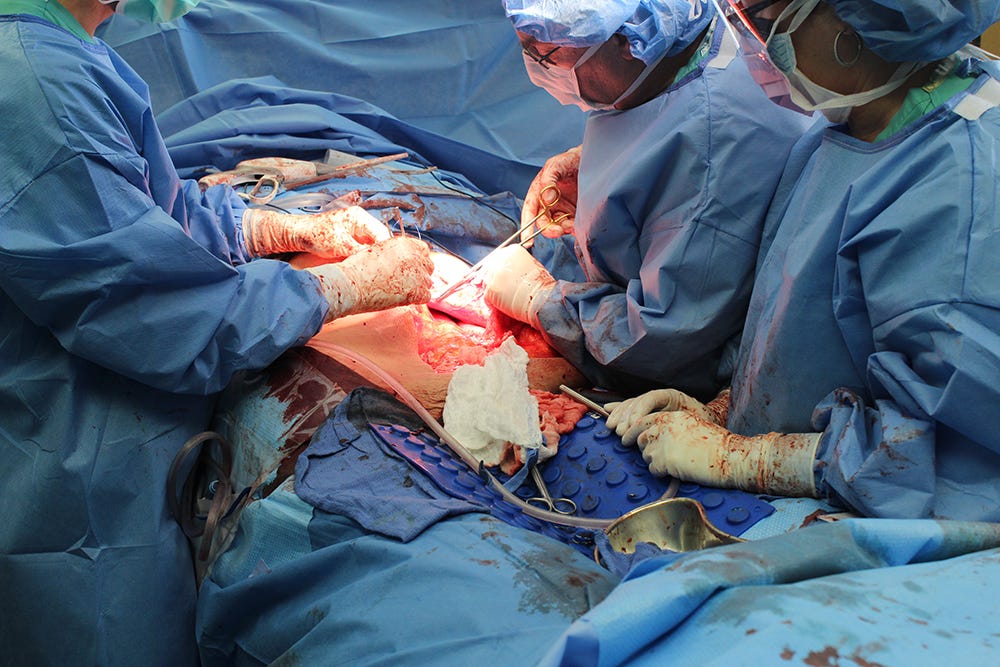 132 pound ovarian tumor removal surgery 