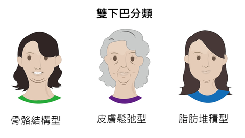 倍克脂消脂針