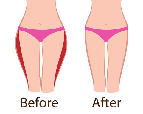 fat and slim girls hips before and after body shaping concept vector illusstration