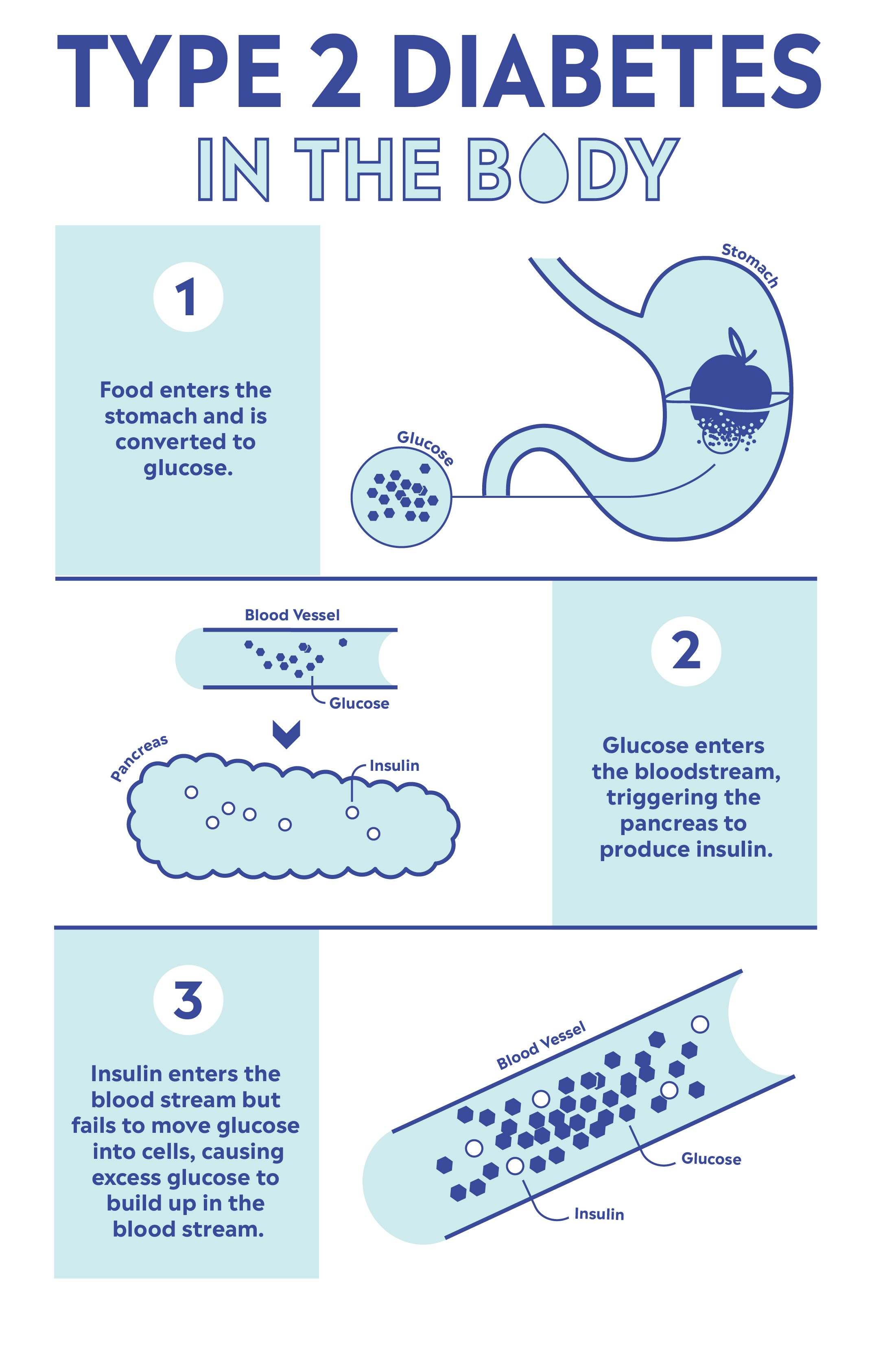 2 Diabetes Causes