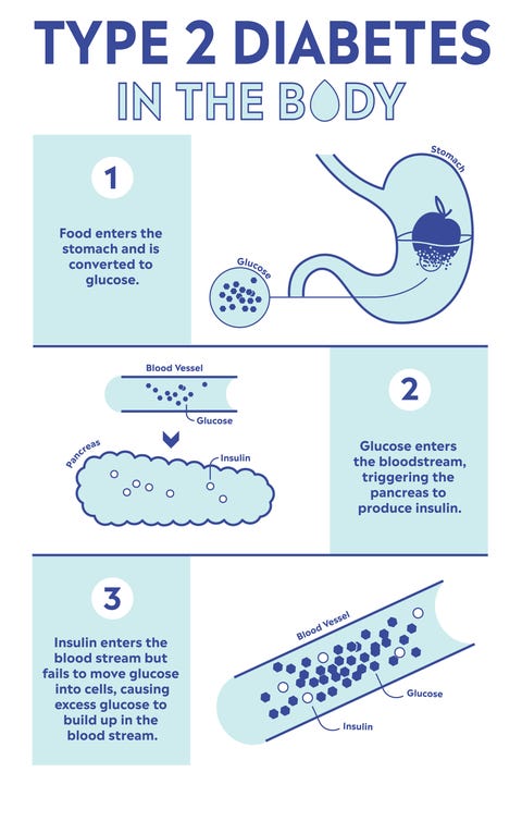 treatment diabetes Type 2 Diabetes Symptoms Treatments Causes Explained by 